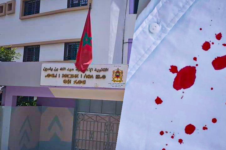 إصابة أستاذ بجروج