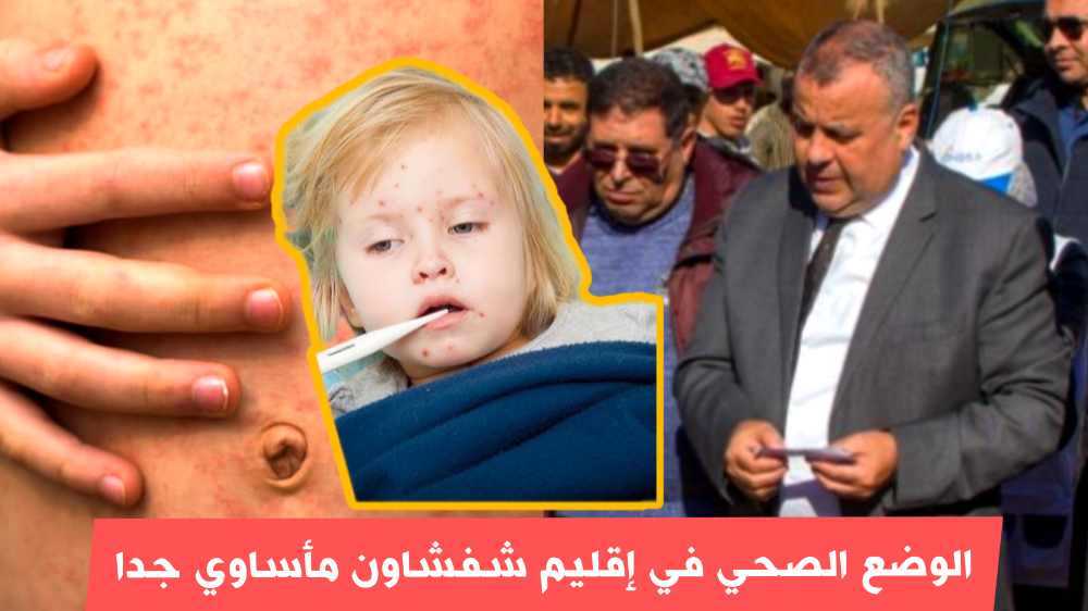 مرض بوحمرون