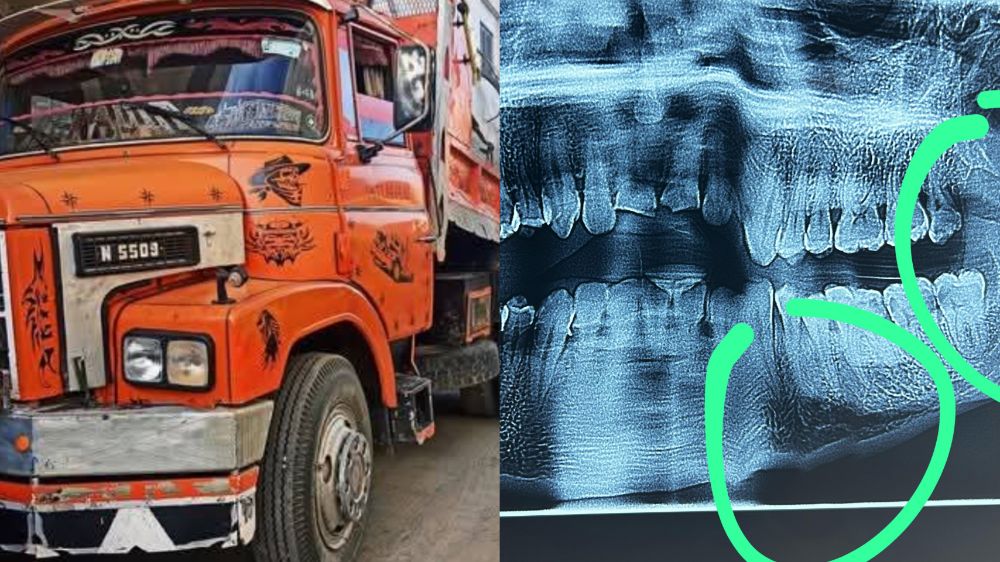 سائق شاحنة مواد البناء في اكزناية يخرج عن صمته  